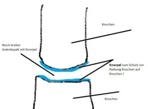 Knorpel im Gelenk