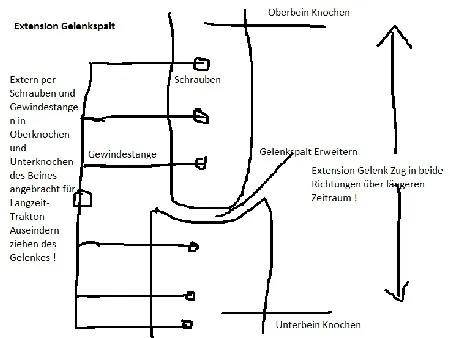 Aufbau Knorpel bei Arthrose 3 Langzeit-Traktion Gelenk Extension